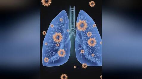 白肺病的症状和原因是什么呢（白肺病有什么症状和病因）