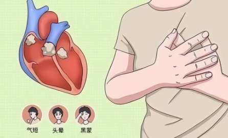 心肌炎有什么症状，得了心肌炎有什么表现
